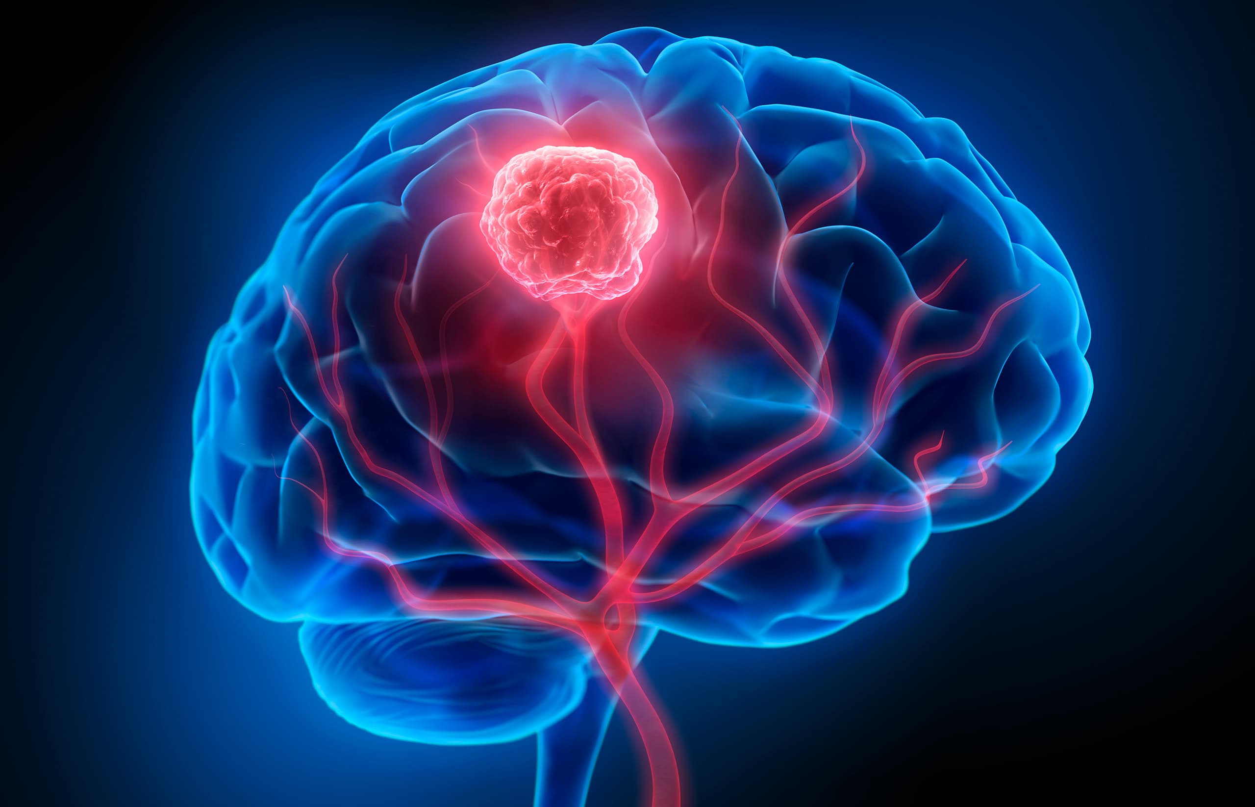 Brain Tumor Detection